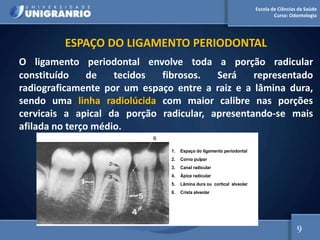 Escola de Ciências da Saúde
Curso: Odontologia
ESPAÇO DO LIGAMENTO PERIODONTAL
O ligamento periodontal envolve toda a porção radicular
constituído de tecidos fibrosos. Será representado
radiograficamente por um espaço entre a raiz e a lâmina dura,
sendo uma linha radiolúcida com maior calibre nas porções
cervicais a apical da porção radicular, apresentando-se mais
afilada no terço médio.
1. Espaço do ligamento periodontal
2. Corno pulpar
3. Canal radicular
4. Ápice radicular
5. Lâmina dura ou cortical alveolar
6. Crista alveolar
6
9
 