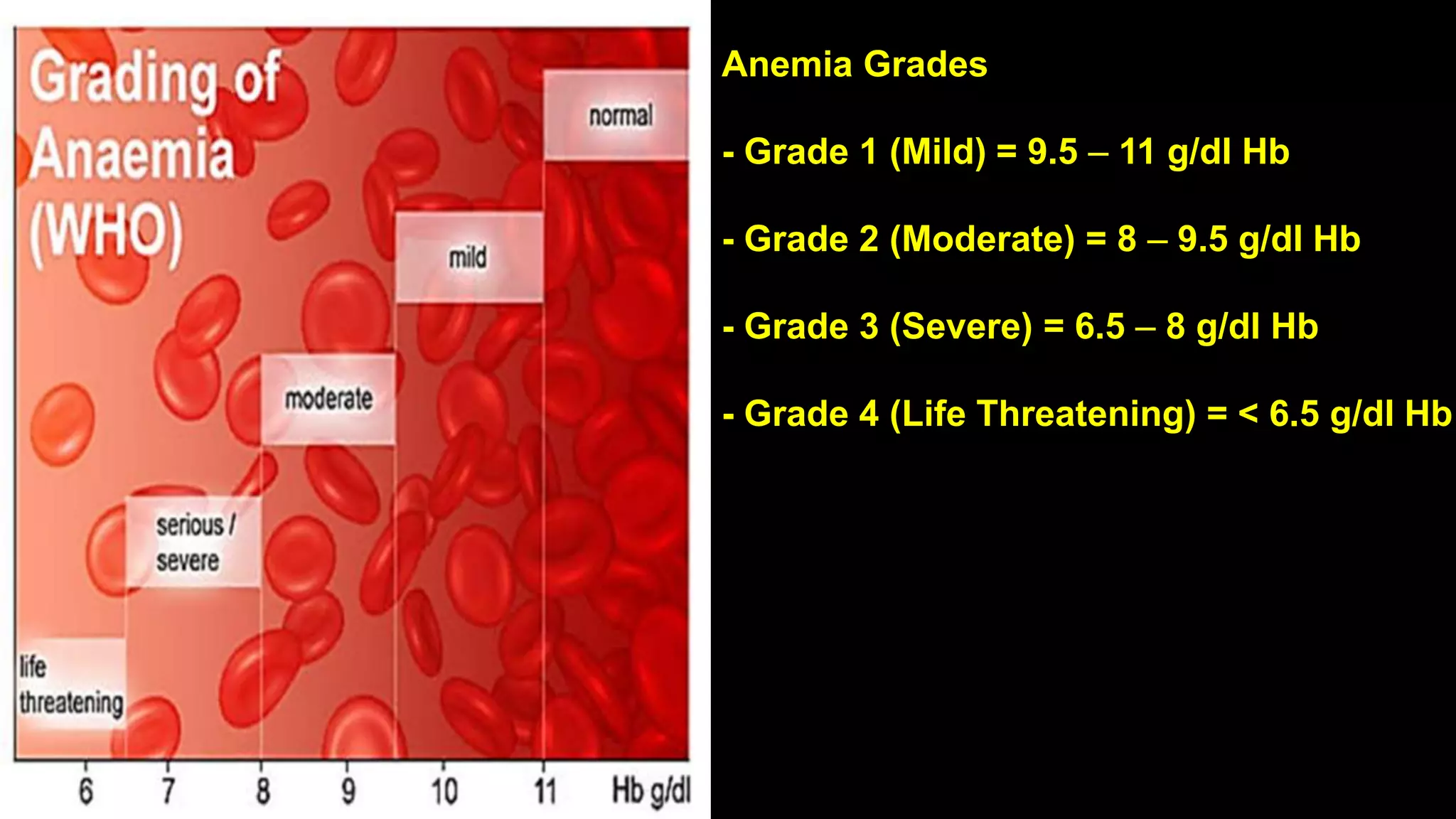 Anemia Grades
- Grade 1 (Mild) = 9.5 – 11 g/dl Hb
- Grade 2 (Moderate) = 8 – 9.5 g/dl Hb
- Grade 3 (Severe) = 6.5 – 8 g/dl Hb
- Grade 4 (Life Threatening) = < 6.5 g/dl Hb
 