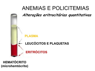 ANEMIAS E POLICITEMIAS
HEMATÓCRITO
(microhemtócrito)
Alterações eritrocitárias quantitativas
LEUCÓCITOS E PLAQUETAS
ERITRÓCITOS
PLASMA
 