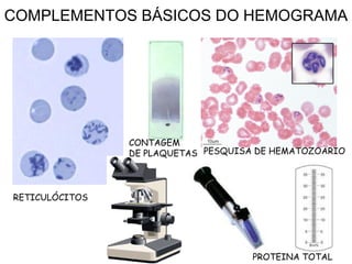 COMPLEMENTOS BÁSICOS DO HEMOGRAMA
RETICULÓCITOS
PROTEINA TOTAL
PESQUISA DE HEMATOZOARIO
CONTAGEM
DE PLAQUETAS
 