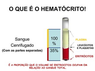 O QUE É O HEMATÓCRITO!
Sangue
Cenrifugado
(Com as partes separadas)
100
%
35%
PLASMA
LEUCÓCITOS
E PLAQUETAS
ERITRÓCITOS
É A PROPORÇÃO QUE O VOLUME DE ERITROCITOS OCUPAM EM
RELAÇÃO AO SANGUE TOTAL.
 