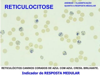 RETICULÓCITOS CANINOS CORADOS DE AZUL COM AZUL CRESIL BRILHANTE.
ANEMIAS – CLASSIFICAÇÃO
QUANTO A RESPOSTA MEDULAR
Indicador de RESPOSTA MEDULAR
RETICULOCITOSE
 