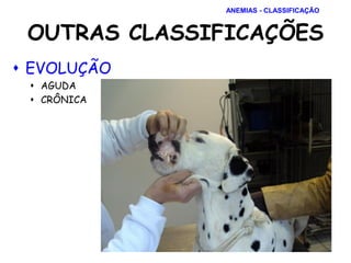  EVOLUÇÃO
 AGUDA
 CRÔNICA
OUTRAS CLASSIFICAÇÕES
ANEMIAS - CLASSIFICAÇÃO
 