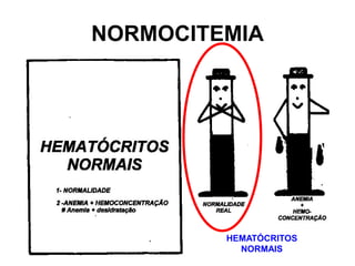 NORMOCITEMIA
HEMATÓCRITOS
NORMAIS
 