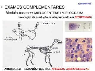  EXAMES COMPLEMENTARES
Medula óssea => MIELOCENTESE / MIELOGRAMA
(avaliação da produção celular, indicado em CITOPENIAS)
8) DIAGNÓSTICO
ABORDAGEM DIAGNÓSTICA DAS ANEMIAS ARRESPONSIVAS
 