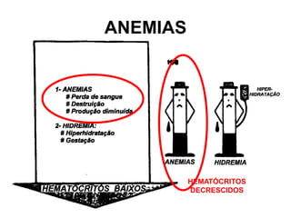 ANEMIAS
HEMATÓCRITOS
DECRESCIDOS
 