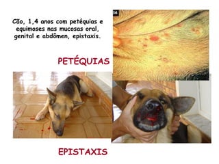 EPISTAXIS
PETÉQUIAS
Cão, 1,4 anos com petéquias e
equimoses nas mucosas oral,
genital e abdômen, epistaxis.
 