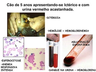 Cão de 5 anos apresentando-se Ictérico e com
urina vermelho acastanhada.
•ICTERICIA
•SANGUE NA URINA - HEMOGLOBINUR
•HEMÓLISE = HEMOGLOBINEMIA
AGLUTINAÇÃO
ESPONTÂNEA
•ESFEROCITOSE
•ANEMIA
RESPONSIVA
INTENSA
 