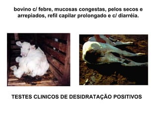 TESTES CLINICOS DE DESIDRATAÇÃO POSITIVOS
bovino c/ febre, mucosas congestas, pelos secos e
arrepiados, refil capilar prolongado e c/ diarréia.
 