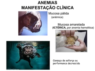 ANEMIAS
MANIFESTAÇÃO CLÍNICA
Mucosa pálida
(anêmica)
Mucosa amarelada
(ICTÉRICA, por anemia hemolitica)
Cansaço de esforço ou
performance decrescida
 