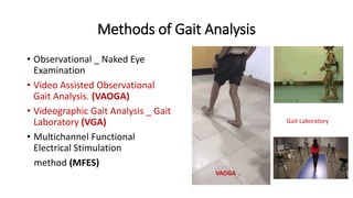 Methods of Gait Analysis
• Observational _ Naked Eye
Examination
• Video Assisted Observational
Gait Analysis. (VAOGA)
• Videographic Gait Analysis _ Gait
Laboratory (VGA)
• Multichannel Functional
Electrical Stimulation
method (MFES)
VAOGA
Gait Laboratory
 
