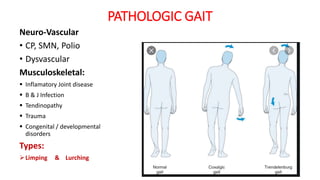 PATHOLOGIC GAIT
Neuro-Vascular
• CP, SMN, Polio
• Dysvascular
Musculoskeletal:
 Inflamatory Joint disease
 B & J Infection
 Tendinopathy
 Trauma
 Congenital / developmental
disorders
Types:
Limping & Lurching
 