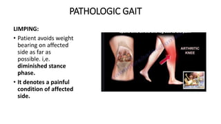 PATHOLOGIC GAIT
LIMPING:
• Patient avoids weight
bearing on affected
side as far as
possible. i,e.
diminished stance
phase.
• It denotes a painful
condition of affected
side.
 
