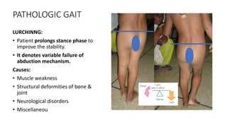 PATHOLOGIC GAIT
LURCHINNG:
• Patient prolongs stance phase to
improve the stability.
• It denotes variable failure of
abduction mechanism.
Causes:
• Muscle weakness
• Structural deformities of bone &
joint
• Neurological disorders
• Miscellaneou
 