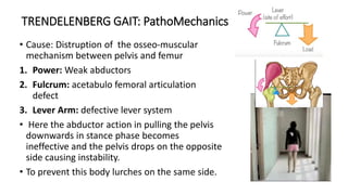 TRENDELENBERG GAIT: PathoMechanics
• Cause: Distruption of the osseo-muscular
mechanism between pelvis and femur
1. Power: Weak abductors
2. Fulcrum: acetabulo femoral articulation
defect
3. Lever Arm: defective lever system
• Here the abductor action in pulling the pelvis
downwards in stance phase becomes
ineffective and the pelvis drops on the opposite
side causing instability.
• To prevent this body lurches on the same side.
 