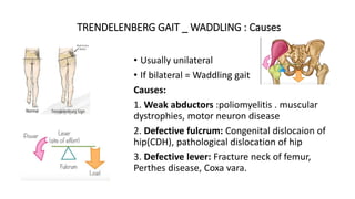 TRENDELENBERG GAIT _ WADDLING : Causes
• Usually unilateral
• If bilateral = Waddling gait
Causes:
1. Weak abductors :poliomyelitis . muscular
dystrophies, motor neuron disease
2. Defective fulcrum: Congenital dislocaion of
hip(CDH), pathological dislocation of hip
3. Defective lever: Fracture neck of femur,
Perthes disease, Coxa vara.
 
