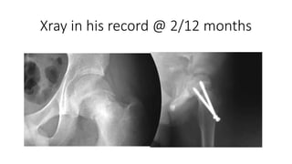 Xray in his record @ 2/12 months
 