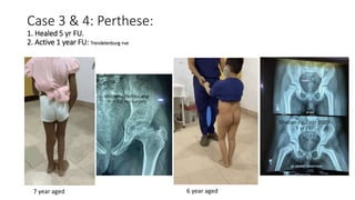 Case 3 & 4: Perthese:
1. Healed 5 yr FU.
2. Active 1 year FU: Trendelenburg +ve
7 year aged 6 year aged
 