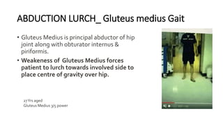 ABDUCTION LURCH_ Gluteus medius Gait
• Gluteus Medius is principal abductor of hip
joint along with obturator internus &
piriformis.
• Weakeness of Gluteus Medius forces
patient to lurch towards involved side to
place centre of gravity over hip.
27Yrs aged
Gluteus Medius 3/5 power
 