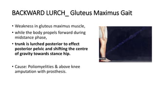 BACKWARD LURCH_ Gluteus Maximus Gait
• Weakness in gluteus maximus muscle,
• while the body propels forward during
midstance phase,
• trunk is lurched posterior to effect
posterior pelvic and shifting the centre
of gravity towards stance hip.
• Cause: Poliomyelities & above knee
amputation with prosthesis.
 
