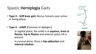 Spastic Hemiplegia Gaits
• Type 3 – Stiff knee gait: Rectus Femoris over active
in Swing phase
• Type 4 – JUMP [Common in diplegics]
In sagittal plane, the ankle is in equinus, knee in
flexion, hip in flexion and anterior pelvic tilt is
present.
In coronal plane, there is hip adduction and
internal rotation.
 