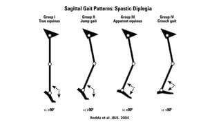 Rodda et al. JBJS. 2004
 