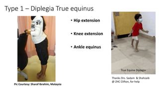 Type 1 – Diplegia True equinus
• Hip extension
• Knee extension
• Ankle equinus
Pic Courtesy: Sharaf Ibrahim, Malaysia
Thanks Drs. Sadam & Shahzaib
@ ZHC Clifton, for help
True Equine Diplegia
 
