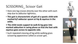 SCISSORING_ Scissor Gait
• Here one leg crosses directly over the other with each
step due to adductor tightness.
• This gait is characteristic of gait of a spastic child with
marked b/l adductor spasm at hip & equinus in the
ankle.
• The child needs support to walk & leg goes into
marked adduction in swing phase so that the foot with
equinus goes across to opposite side.
• Such repeated crossing of leg while walking gives
scissoring appearance called as scissor gait.
 