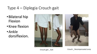 Type 4 – Diplegia Crouch gait
•Bilateral hip
Flexion
•Knee flexion
•Ankle
dorsiflexion.
Crouch _ Decompensated JumpCrouch gait _ Gait
 