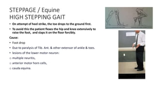 STEPPAGE / Equine
HIGH STEPPING GAIT
• On attempt of heel strike, the toe drops to the ground first.
• To avoid this the patient flexes the hip and knee extensively to
raise the foot, and slaps it on the floor forcibly.
Cause:
• Foot drop
• Due to paralysis of Tib. Ant. & other extensor of ankle & toes.
• lesions of the lower motor neuron:
o multiple neuritis,
o anterior motor horn cells,
o cauda equina.
 