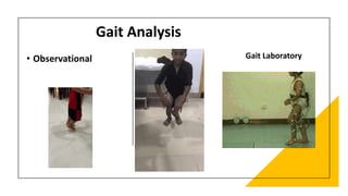 Gait Analysis
• Observational Gait Laboratory
 