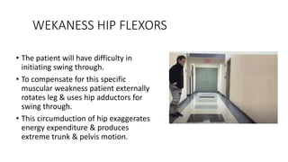 WEKANESS HIP FLEXORS
• The patient will have difficulty in
initiating swing through.
• To compensate for this specific
muscular weakness patient externally
rotates leg & uses hip adductors for
swing through.
• This circumduction of hip exaggerates
energy expenditure & produces
extreme trunk & pelvis motion.
 