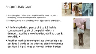 SHORT LIMB GAIT
• Shortening less than 1.5 cm compensated by pelvic tilt, and
shortening upto 5 cm compensated by equinus.
• Shortening more than 5 cm the patient dips his body on that side.
• A limb length discripancy of 1 to 1.5 inch is
compensated by tilt of the pelvis,which is
demonstrated by a low shoulder,low iliac crest &
low ASIS. •
• Another method to compensate shortening is to
put foot & ankle at the affected side into equinus
position & hip & knee of normal limb in flexion.
 
