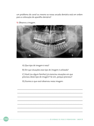 um problema de canal ou mesmo se nossa arcada dentária está em ordem
para a colocação de aparelho dentário?

Foto Divulgação

1.		 bserve a imagem.
O

	

A) Que tipo de imagem é esta?

	

B) Em que situações esse tipo de imagem é utilizada?

	
	

C) Você (ou algum familiar) já vivenciou situações em que 			
precisou deste tipo de imagem? Se sim, porque precisou?

	

D) Escreva o que você observou nesta imagem:
______________________________________________________________
______________________________________________________________
______________________________________________________________
______________________________________________________________
______________________________________________________________
______________________________________________________________
______________________________________________________________

 

112

 

    cadernos de apoio e aprendizagem · SmESP  

 
