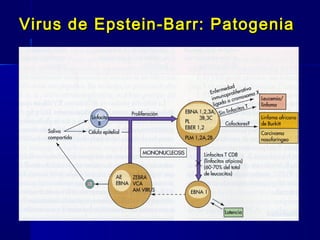 Virus de Epstein-Barr: PatogeniaVirus de Epstein-Barr: Patogenia
 