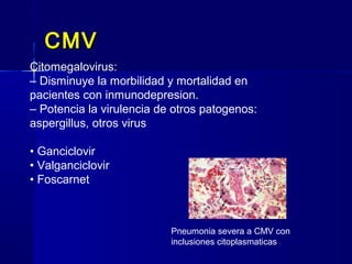 CMVCMV
Pneumonia severa a CMV con
inclusiones citoplasmaticas
Citomegalovirus:
– Disminuye la morbilidad y mortalidad en
pacientes con inmunodepresion.
– Potencia la virulencia de otros patogenos:
aspergillus, otros virus
• Ganciclovir
• Valganciclovir
• Foscarnet
 