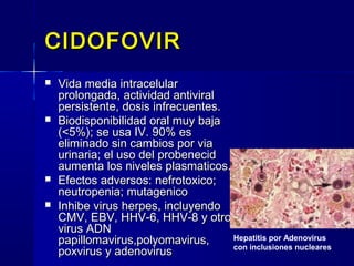 CIDOFOVIRCIDOFOVIR
 Vida media intracelularVida media intracelular
prolongada, actividad antiviralprolongada, actividad antiviral
persistente, dosis infrecuentes.persistente, dosis infrecuentes.
 Biodisponibilidad oral muy bajaBiodisponibilidad oral muy baja
(<5%); se usa IV. 90% es(<5%); se usa IV. 90% es
eliminado sin cambios por viaeliminado sin cambios por via
urinaria; el uso del probenecidurinaria; el uso del probenecid
aumenta los niveles plasmaticos.aumenta los niveles plasmaticos.
 Efectos adversos: nefrotoxico;Efectos adversos: nefrotoxico;
neutropenia; mutageniconeutropenia; mutagenico
 Inhibe virus herpes, incluyendoInhibe virus herpes, incluyendo
CMV, EBV, HHV-6, HHV-8 y otrosCMV, EBV, HHV-6, HHV-8 y otros
virus ADNvirus ADN
papillomavirus,polyomavirus,papillomavirus,polyomavirus,
poxvirus y adenoviruspoxvirus y adenovirus
Hepatitis por Adenovirus
con inclusiones nucleares
 