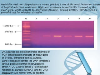 Hammed Pcr Polymerase chain reaction (PCR) BY DR YOUSIF HAMED MOHAMED SHARIF | PPT