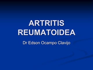 ARTRITIS 
REUMATOIDEA 
Dr Edson Ocampo Clavijo 
 