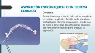 ASPIRACIÓN ENDOTRAQUEAL CON SISTEMA
CERRADO Concepto:
Procedimiento por medio del cual se introduce
un catéter de plástico flexible en la vía aérea
artificial para eliminar secreciones, con la que
se evite el tener que desconectar al paciente
del ventilador mecánico para efectuar la
aspiración.
 