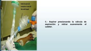 6.- Aspirar presionando la válvula de
aspiración y retirar suavemente el
catéter.
 