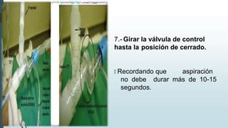 7.- Girar la válvula de control
hasta la posición de cerrado.
🠶 Recordando que aspiración
no debe durar más de 10-15
segundos.
 