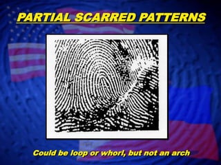 Scarred Patterns | PPTX