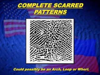 Scarred Patterns | PPTX