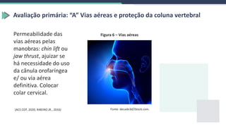 Avaliação primária: “A” Vias aéreas e proteção da coluna vertebral
Permeabilidade das
vias aéreas pelas
manobras: chin lift ou
jaw thrust, ajuizar se
há necessidade do uso
da cânula orofaríngea
e/ ou via aérea
definitiva. Colocar
colar cervical.
Figura 6 – Vias aéreas
Fonte: decade3d/iStock.com.
(ACS COT, 2020; RIBEIRO JR., 2016)
 