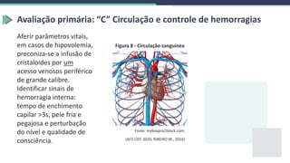 Avaliação primária: “C” Circulação e controle de hemorragias
Aferir parâmetros vitais,
em casos de hipovolemia,
preconiza-se a infusão de
cristaloides por um
acesso venosos periférico
de grande calibre.
Identificar sinais de
hemorragia interna:
tempo de enchimento
capilar >3s, pele fria e
pegajosa e perturbação
do nível e qualidade de
consciência.
Figura 8 - Circulação sanguínea
Fonte: myboxpra/iStock.com.
(ACS COT, 2020; RIBEIRO JR., 2016)
 
