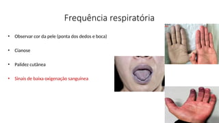 Frequência respiratória
• Observar cor da pele (ponta dos dedos e boca)
• Cianose
• Palidez cutânea
• Sinais de baixa oxigenação sanguínea
 