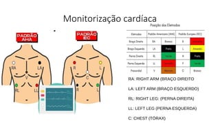 Monitorização cardíaca
RA: RIGHT ARM (BRAÇO DIREITO
LA: LEFT ARM (BRAÇO ESQUERDO)
RL: RIGHT LEG: (PERNA DIREITA)
LL: LEFT LEG (PERNA ESQUERDA)
C: CHEST (TÓRAX)
 