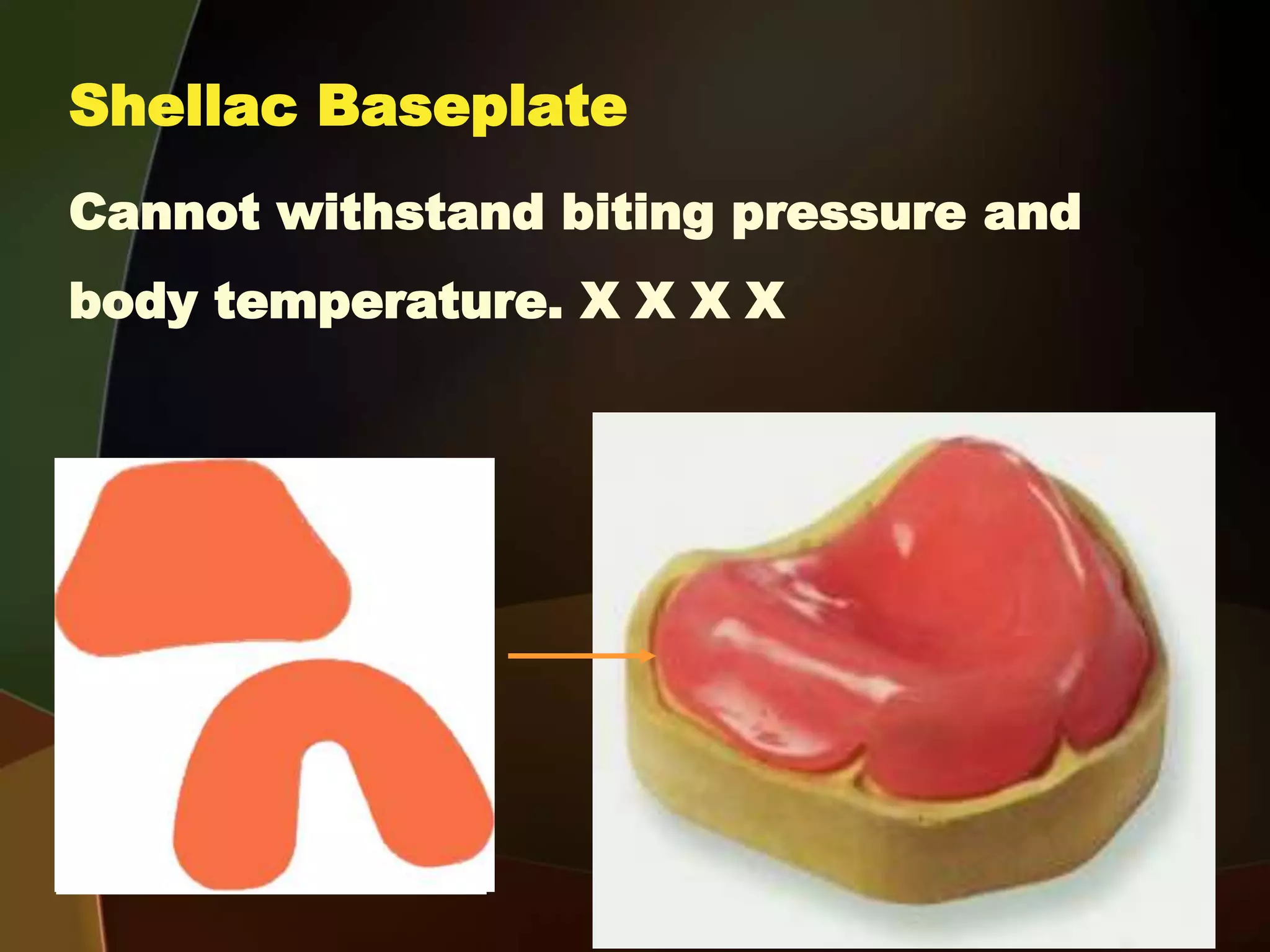 Shellac Basplate 4- b Steps of recording jaw relation for completely edentulous patients ...