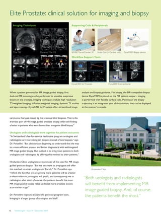 FieldStrength – Issue 39 – December 200912
carcinoma that was missed by the previous blind biopsies. That is the
dramatic part of MR image guided prostate biopsy: often still finding
a lesion in patients who went home after a negative blind biopsy.”
Urologists and radiologists work together for patient outcomes
“In Switzerland’s fee-for-service healthcare program urologists and
radiologists earn more doing ten biopsies instead of two biopsies,” says
Dr. Porcellini. “But clinicians are beginning to understand that the way
to a more efficient process and better diagnosis is with well-targeted
MR image guided biopsy. Our outlook is to bring more patients to both
urologists and radiologists by offering this method to their patients.”
Hirslanden Clinic urologists are convinced of the need for MR image
guided prostate biopsy. “But we also want to propagate and offer
this method to other urologists in Zurich,” Dr. Porcellini says.
“I think the fact that we are getting more patients will be a factor
in these referrals; urologists will profit, and consequently we as
radiologists also. And, of course, the patients benefit the most.
MR image guided biopsy helps us detect more prostate lesions
at an earlier stage.”
Dr. Porcellini hopes to expand the prostate program soon,
bringing in a larger group of urologists and staff.
Hirslanden Clinic
“Both urologists and radiologists
will benefit from implementing MR
image guided biopsy. And, of course,
the patients benefit the most.”
Elite Prostate: clinical solution for imaging and biopsy
T2w TSE
DynaLOC InterventionalDynaCAD for Prostate
(multi b-value) Diffusion
Dynamic T1w FFE
3D Spectroscopy
When a patient presents for MR image guided biopsy, first
dual-coil MR scanning can be performed to visualize suspicious
lesions in the prostate. Imaging techniques include high resolution
T2-weighted imaging, diffusion weighted imaging, dynamic T1 studies
and spectroscopy. DynaCAD for Prostate offers streamlined image
Imaging Techniques
SENSE Torso/Cardiac 32 Endo Coil (+ Cardiac coil) DynaTRIM Biopsy device
Supporting Coils  Peripherals
Workflow Support Tools
analysis and biopsy guidance. For biopsy, the MR-compatible biopsy
device DynaTRIM is placed on the MR patient support, imaging
is performed with flexible surface coils. Planning of the biopsy
trajectory is an integrated part of the solution, that can be displayed
at the scanner’s console.
 
